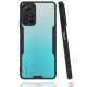  Xiaomi Redmi Note 11 Pro Plus 5G Kılıf Platin Silikon - Siyah