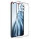Xiaomi Mi 11 Kılıf Lüx Şeffaf Silikon - Kılıf's Xiaomi Mi 11 Kılıf Lüx Şeffaf Silikon