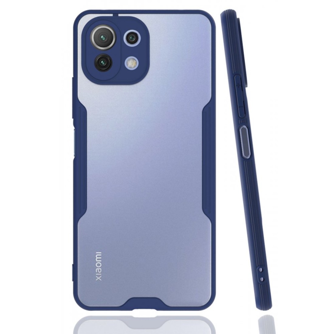 Xiaomi Mİ 11 Lite Kılıf Platin Silikon - Siyah - Kılıf's Xiaomi Mİ 11 Lite Kılıf Platin Silikon - Siyah