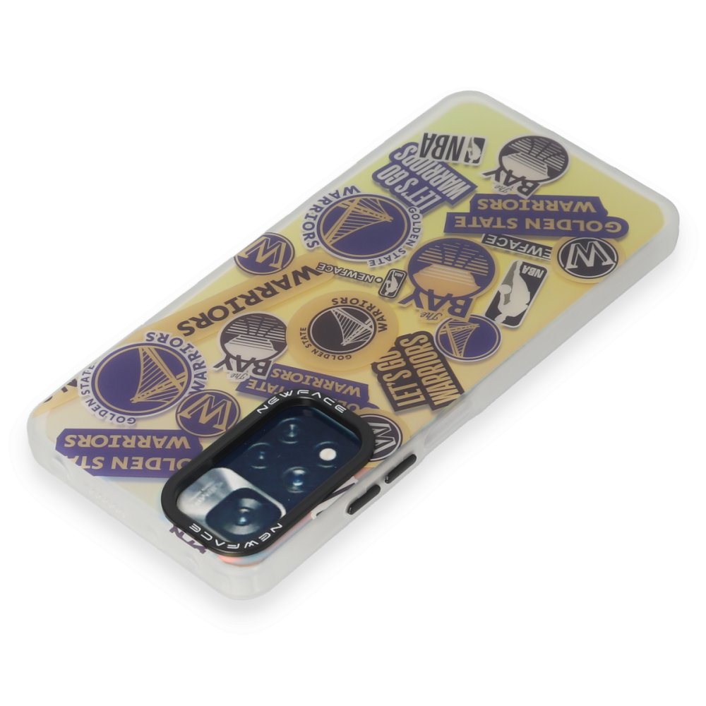 Redmi Note 11 Pro Kılıf Estoril Desenli Kapak - Estoril - 13