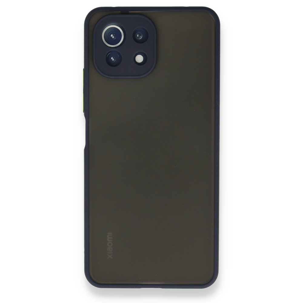 Xiaomi Mİ 11 Lite Kılıf Montreal Silikon Kapak - Lacivert  Xiaomi Mİ 11 Lite Kılıf Montreal Silikon Kapak - Lacivert