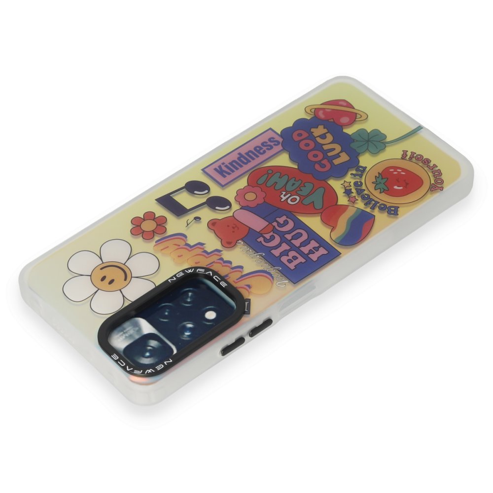 Redmi Note 11 Pro Kılıf Estoril Desenli Kapak - Estoril - 15