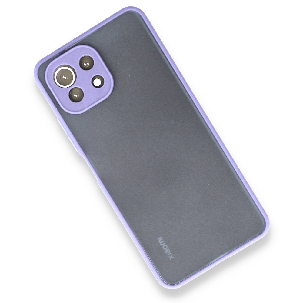 Xiaomi Mİ 11 Lite Kılıf Montreal Silikon Kapak - Mor Xiaomi Mİ 11 Lite Kılıf Montreal Silikon Kapak - Mor