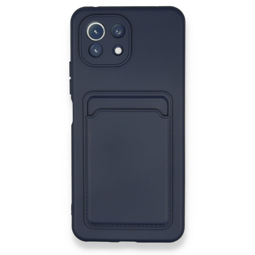  Xiaomi Mi 11 Kılıf Kelvin Kartvizitli Silikon - Lacivert