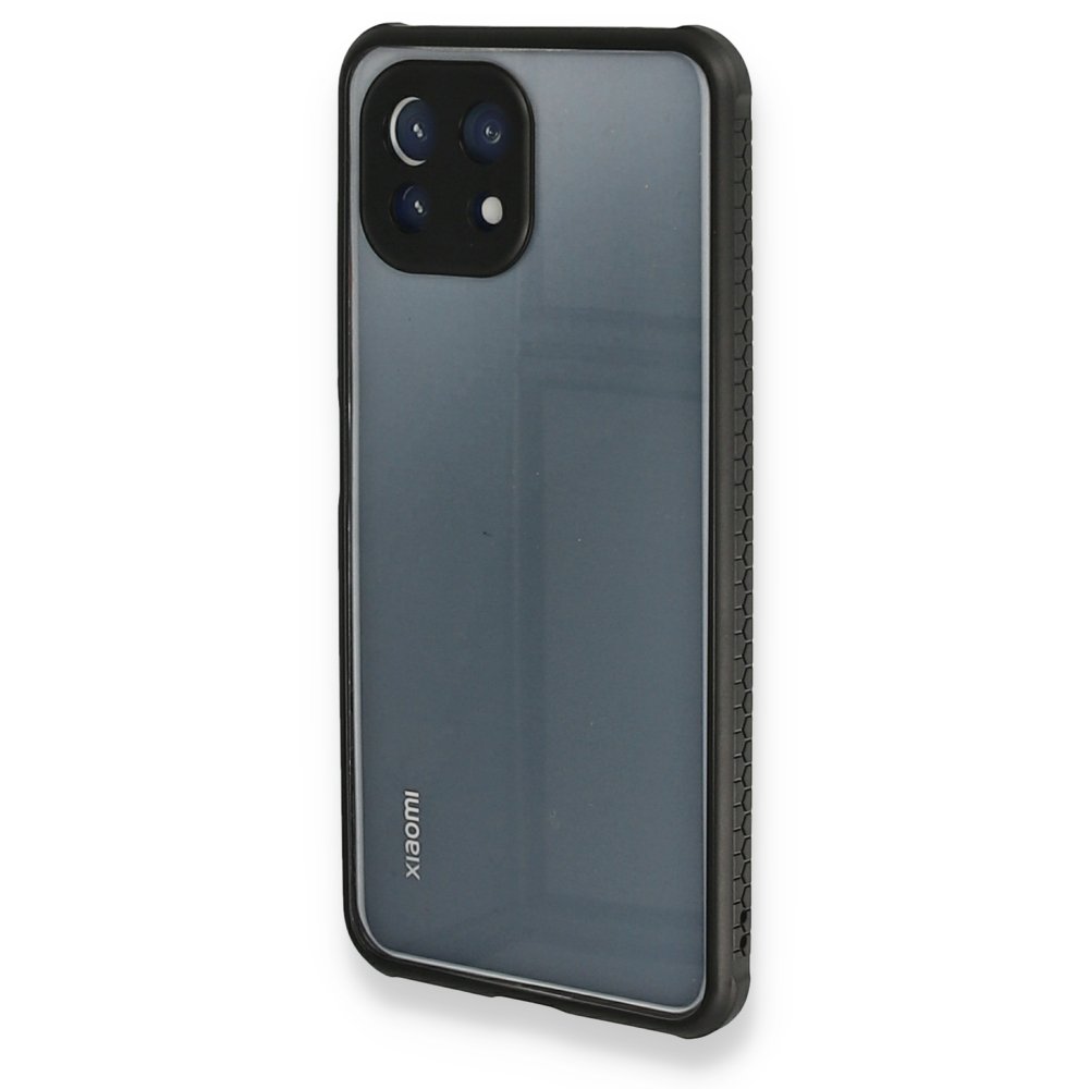 Xiaomi Mİ 11 Lite Kılıf Miami Şeffaf Silikon - Siyah  Xiaomi Mİ 11 Lite Kılıf Miami Şeffaf Silikon - Siyah