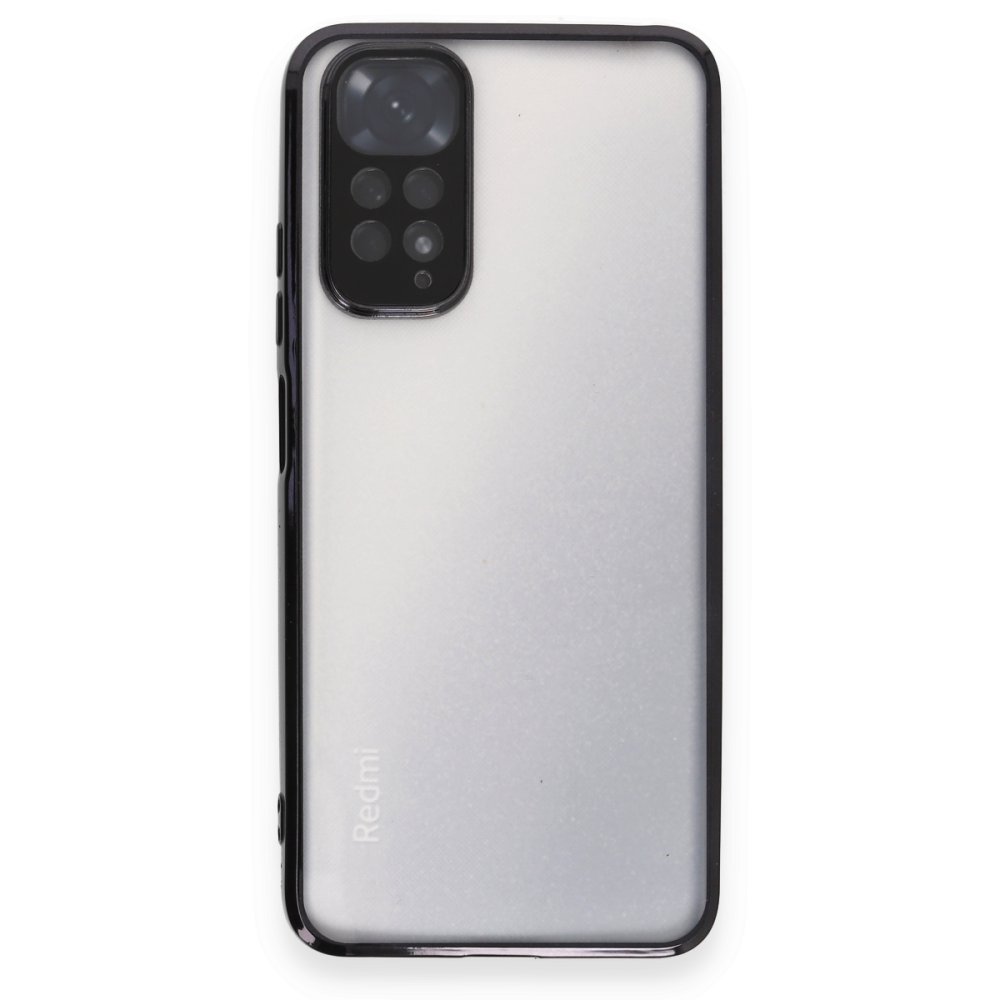 Redmi Note 11S Kılıf Razer Lensli Silikon - Siyah
