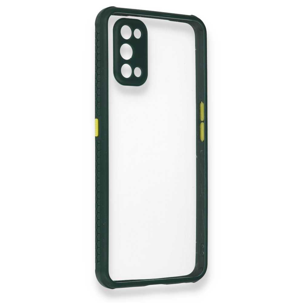 Realme 7 Pro Kılıf Miami Şeffaf Silikon - Koyu Yeşil  Realme 7 Pro Kılıf Miami Şeffaf Silikon - Koyu Yeşil