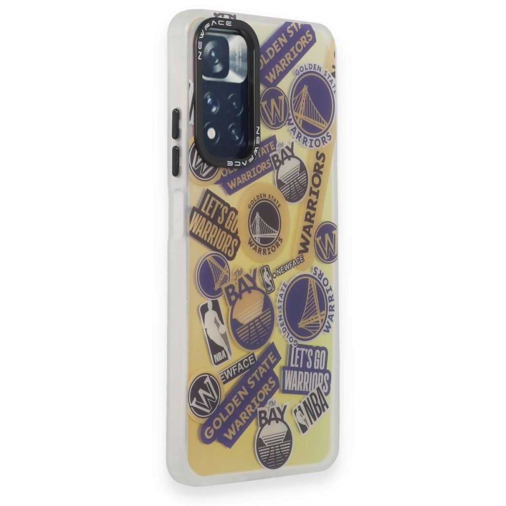 Redmi Note 11 Pro Kılıf Estoril Desenli Kapak - Estoril - 13