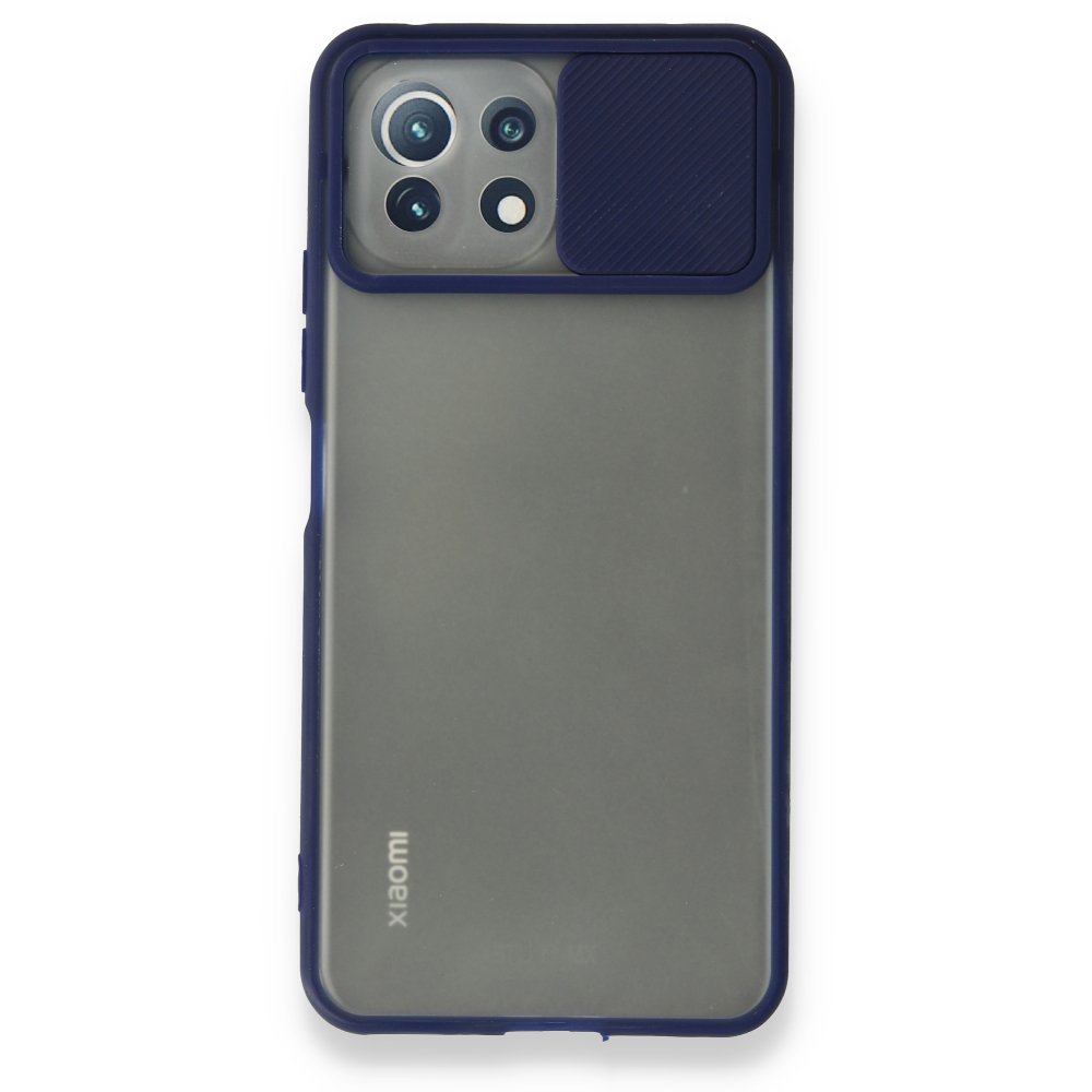 Xiaomi Mİ 11 Lite Kılıf Palm Buzlu Kamera Sürgülü Silikon - Lacivert  Xiaomi Mİ 11 Lite Kılıf Palm Buzlu Kamera Sürgülü Silikon - Lacivert
