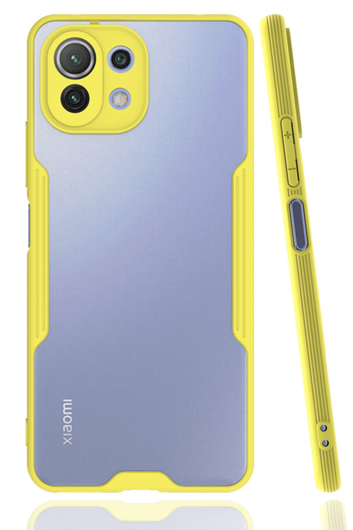 Xiaomi Mİ 11 Lite Kılıf Platin Silikon - Sarı  Xiaomi Mİ 11 Lite Kılıf Platin Silikon - Sarı