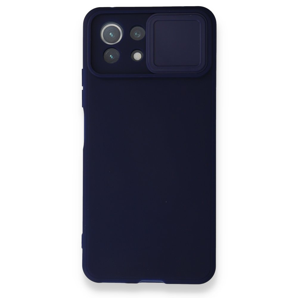 Xiaomi Mİ 11 Lite Kılıf Color Lens Silikon - Lacivert  Xiaomi Mİ 11 Lite Kılıf Color Lens Silikon - Lacivert