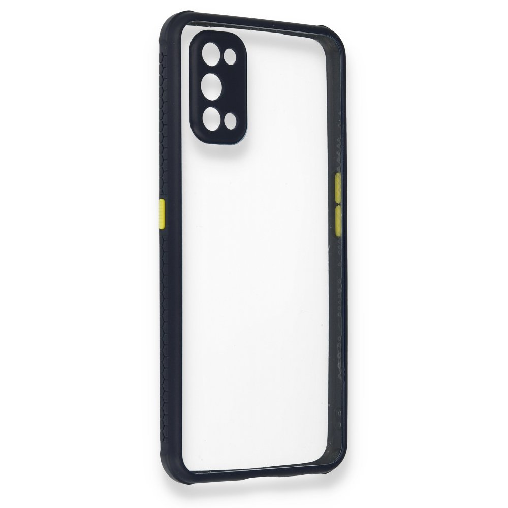 Realme 7 Pro Kılıf Miami Şeffaf Silikon - Lacivert  Realme 7 Pro Kılıf Miami Şeffaf Silikon - Lacivert