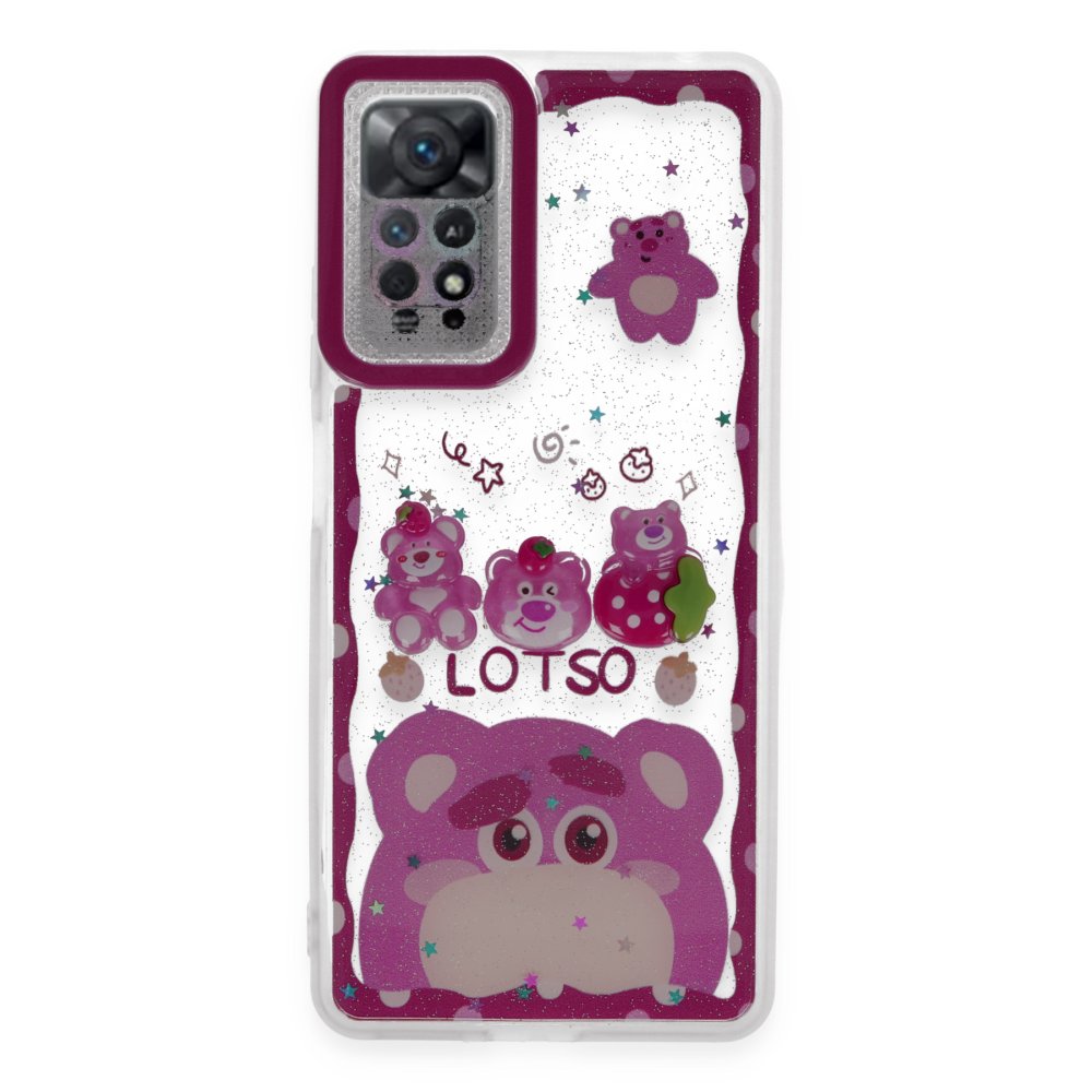 Redmi Note 11S Kılıf Sweet Desenli Silikon Kapak - Pembe
