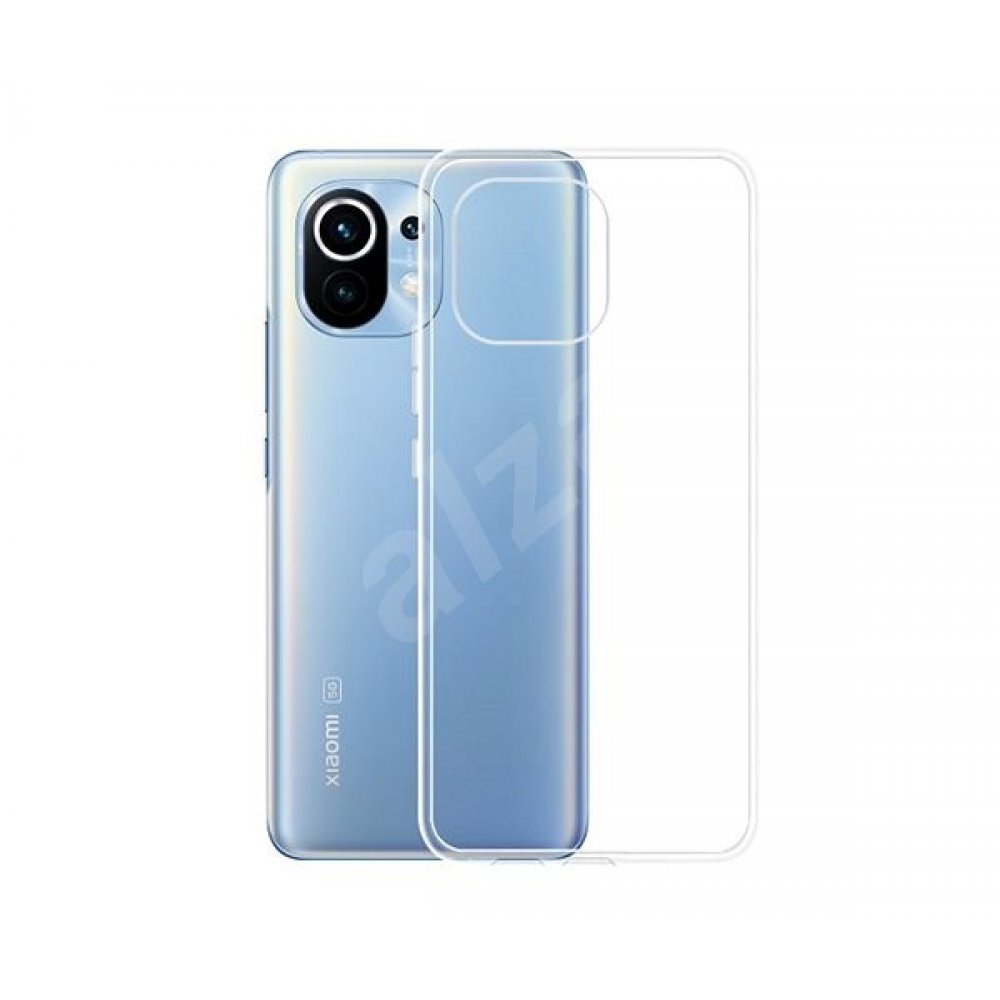  Xiaomi Mi 11 Kılıf Lüx Şeffaf Silikon