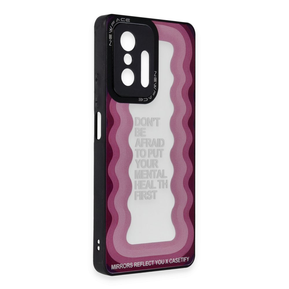  Xiaomi Mi 11T Kılıf Mirror Desenli Kapak - Mirror - 11