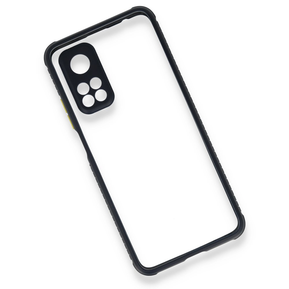  Xiaomi Mi 10T Pro Kılıf Miami Şeffaf Silikon - Lacivert