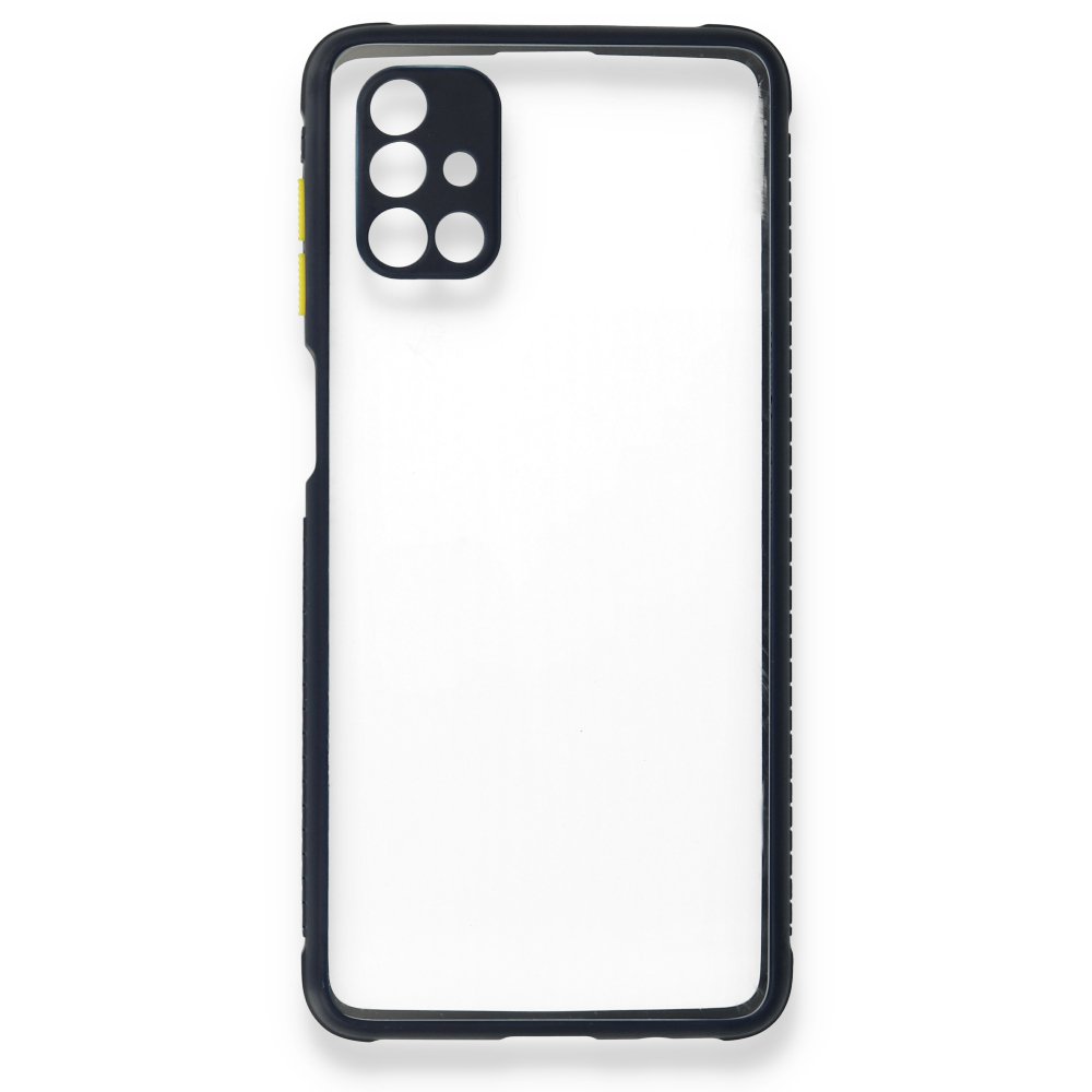  Samsung Galaxy M51 Kılıf Miami Şeffaf Silikon - Lacivert
