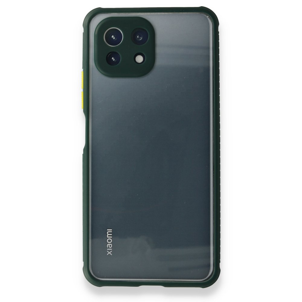 Xiaomi Mİ 11 Lite Kılıf Miami Şeffaf Silikon - Koyu Yeşil  Xiaomi Mİ 11 Lite Kılıf Miami Şeffaf Silikon - Koyu Yeşil