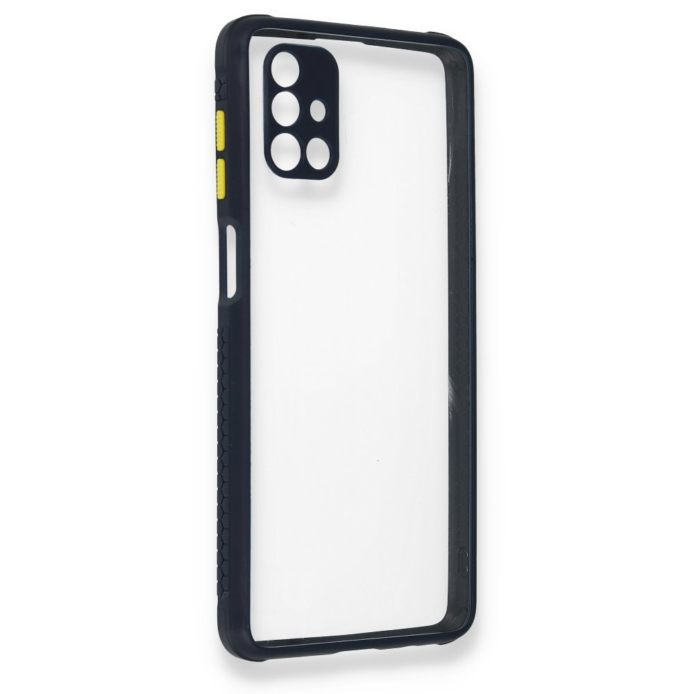  Samsung Galaxy M51 Kılıf Miami Şeffaf Silikon - Lacivert