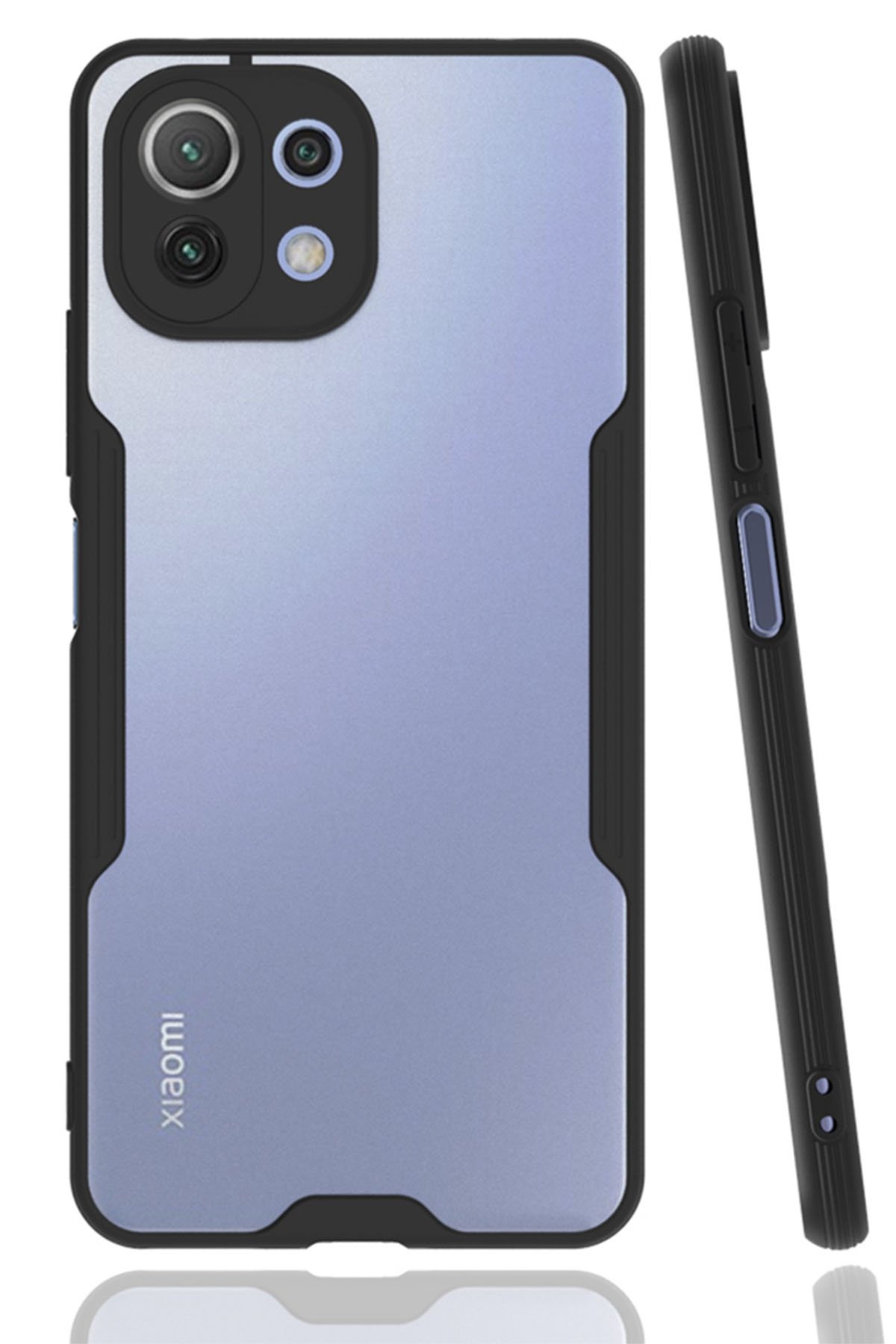 Xiaomi Mİ 11 Lite Kılıf Platin Silikon - Siyah  Xiaomi Mİ 11 Lite Kılıf Platin Silikon - Siyah