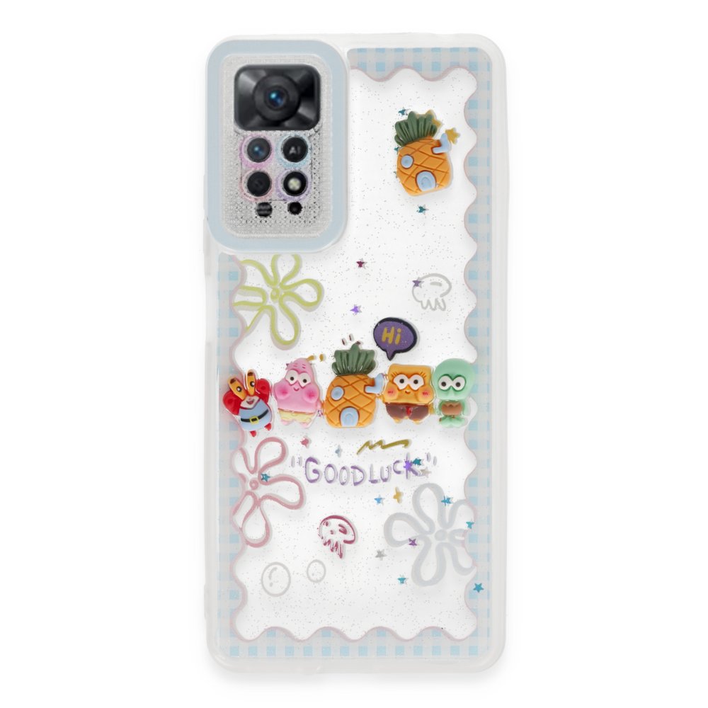 Redmi Note 11S Kılıf Sweet Desenli Silikon Kapak - Açık Mavi