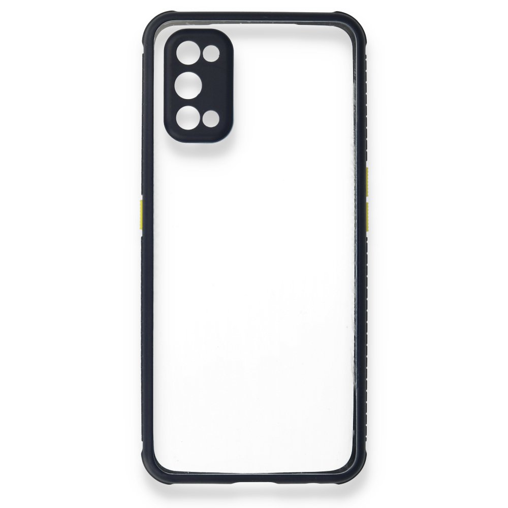 Realme 7 Pro Kılıf Miami Şeffaf Silikon - Lacivert  Realme 7 Pro Kılıf Miami Şeffaf Silikon - Lacivert