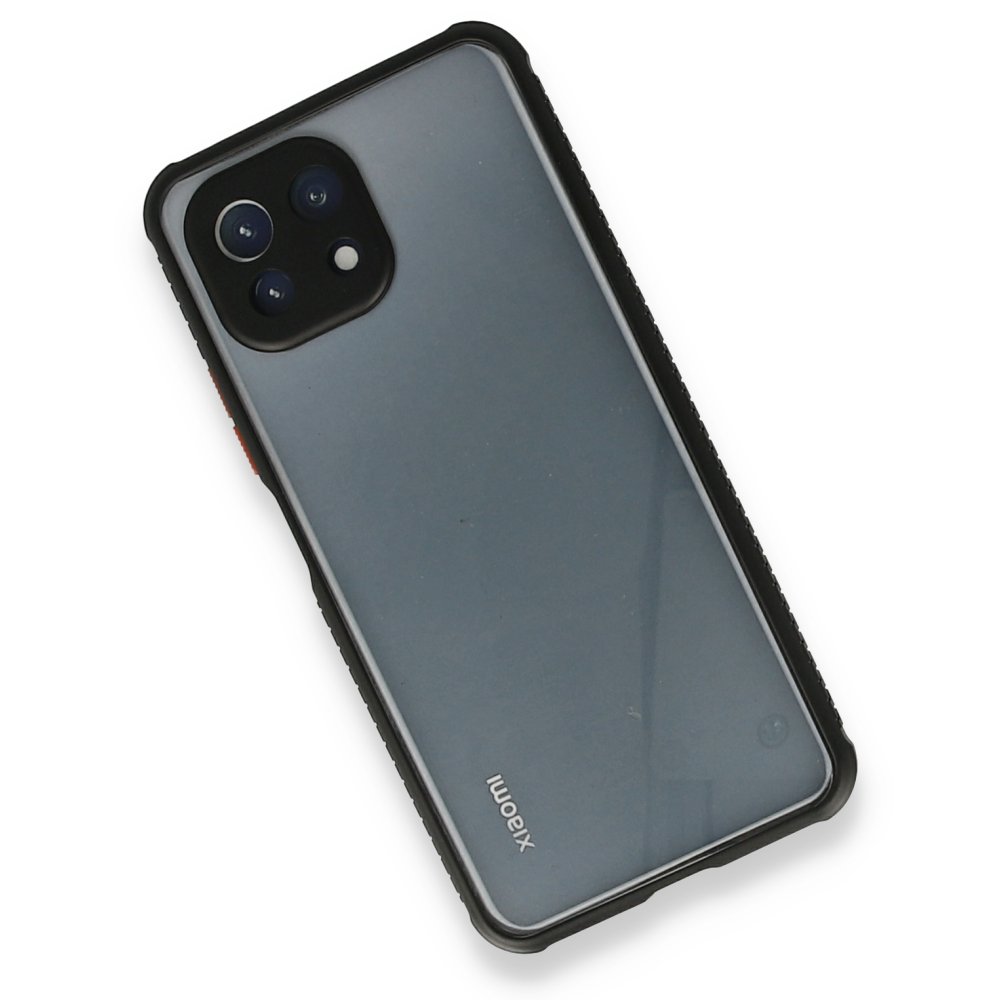 Xiaomi Mİ 11 Lite Kılıf Miami Şeffaf Silikon - Siyah  Xiaomi Mİ 11 Lite Kılıf Miami Şeffaf Silikon - Siyah