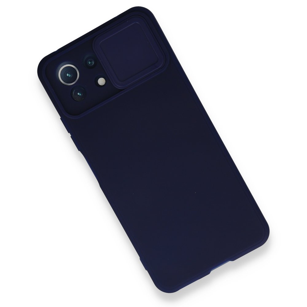 Xiaomi Mİ 11 Lite Kılıf Color Lens Silikon - Lacivert  Xiaomi Mİ 11 Lite Kılıf Color Lens Silikon - Lacivert